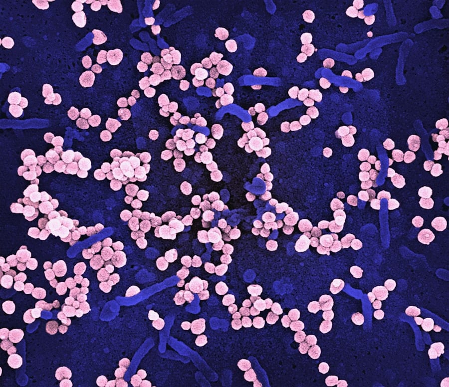 Photo erbsenprotein reisprotein hanfprotein
